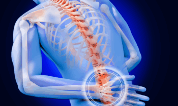 Jordan Sudberg Answers: How Long Do Spinal Cord Stimulators Really Last?